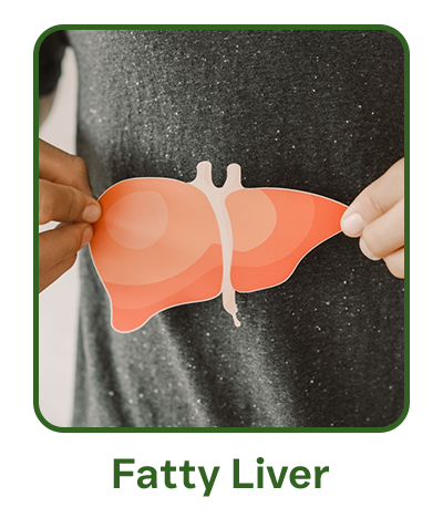 fatty liver